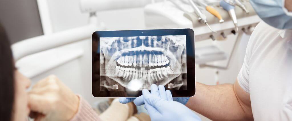 Are Dental X-Rays Safe? Debunking Myths and Addressing Concerns